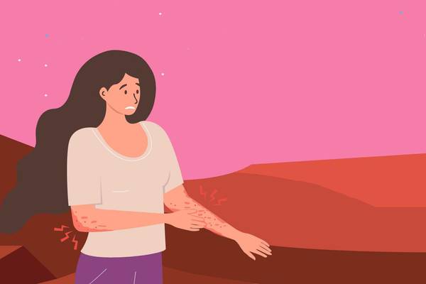 Type 2 Inflammation May Be Contributing to Your Atopic Dermatitis graphic