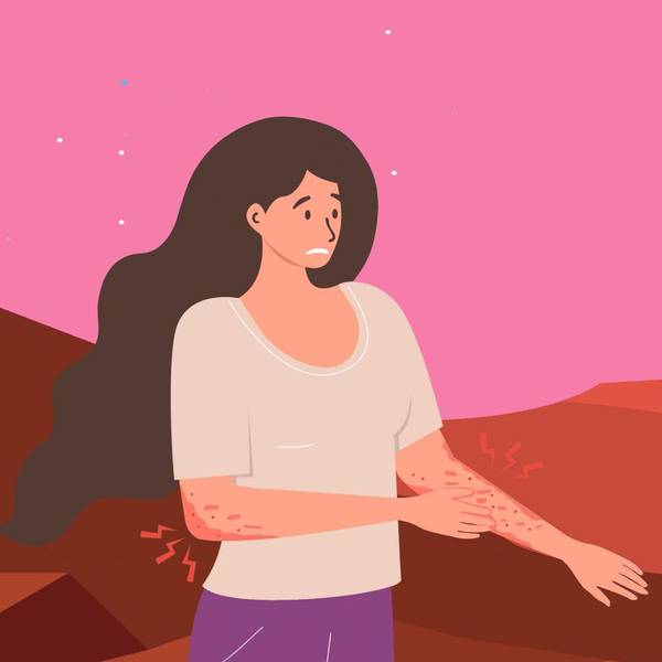 Type 2 Inflammation May Be Contributing to Your Atopic Dermatitis