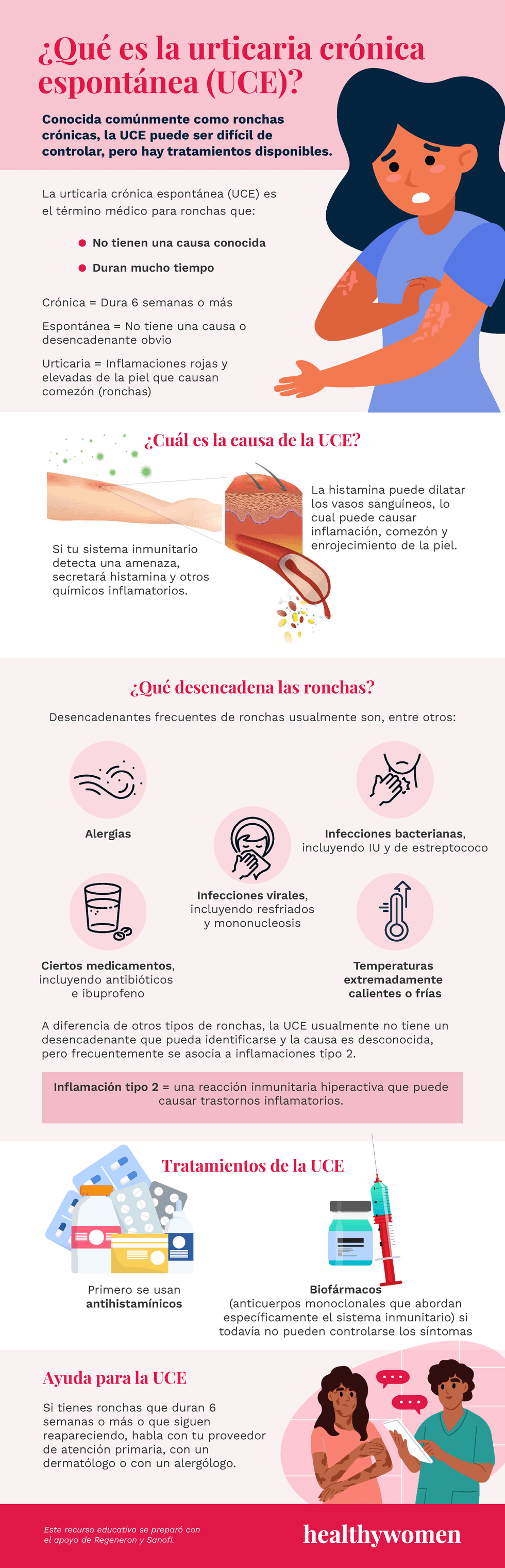 \u00bfQu\u00e9 es la urticaria cr\u00f3nica espont\u00e1nea (UCE)?
