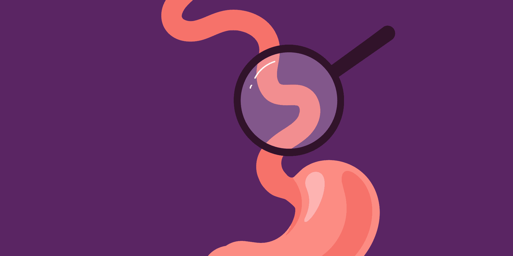 Understanding and Managing Eosinophilic Esophagitis (EoE) infographic