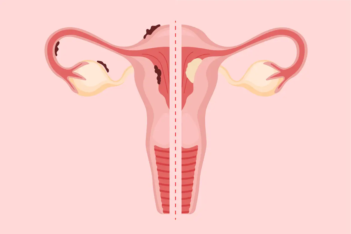 uterus