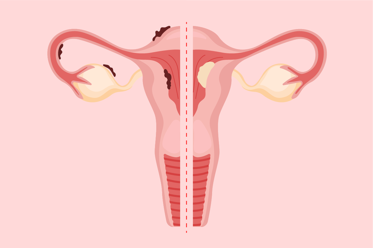 uterus