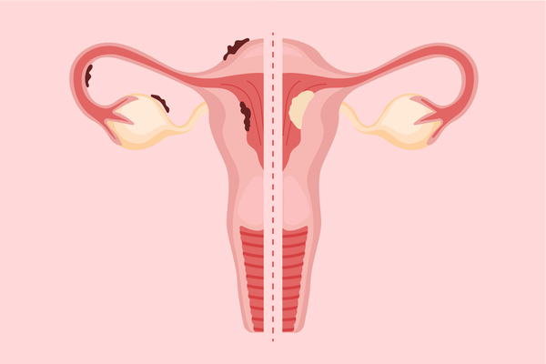 uterus