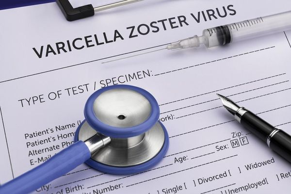 Varicella Vaccine