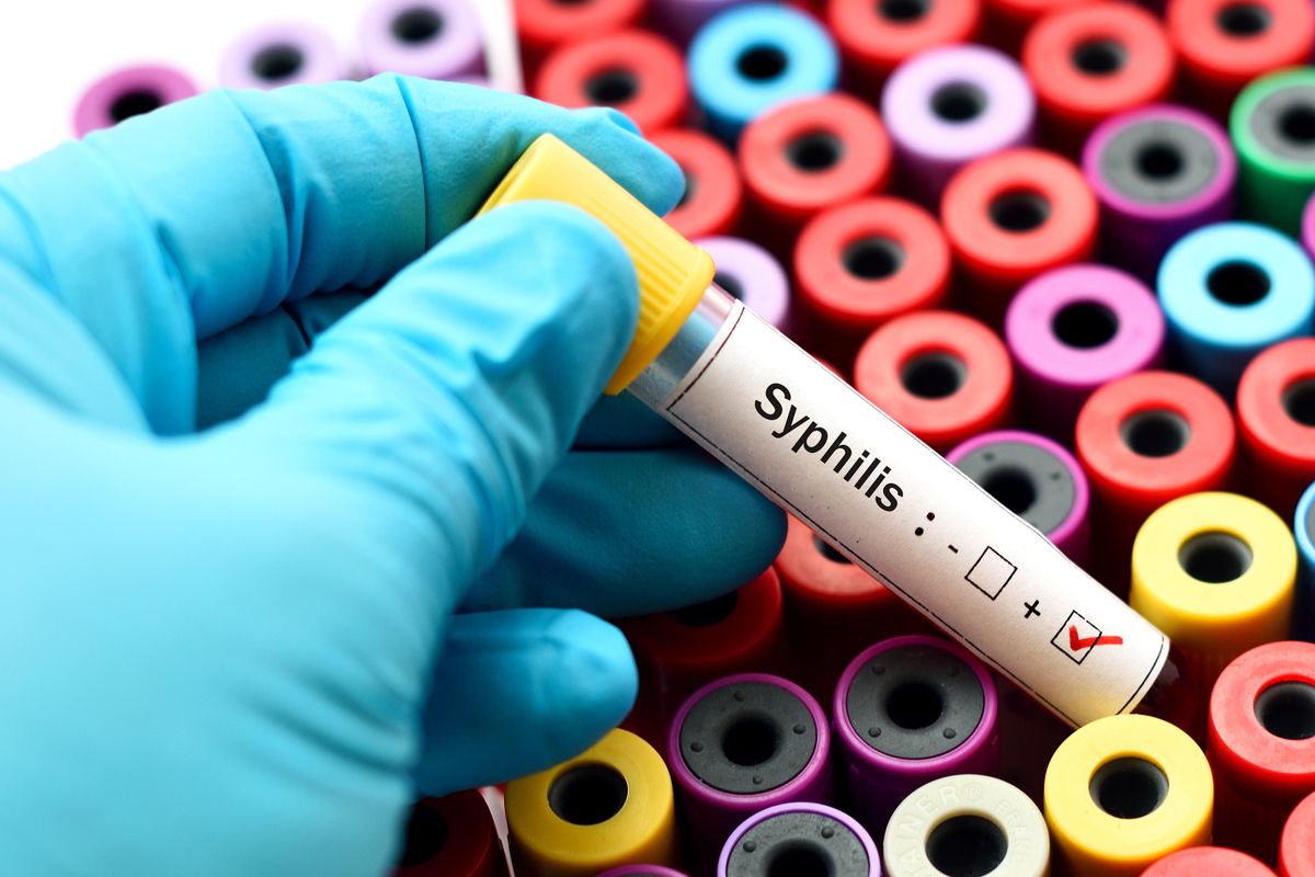 vials of blood with Syphilis positive on it