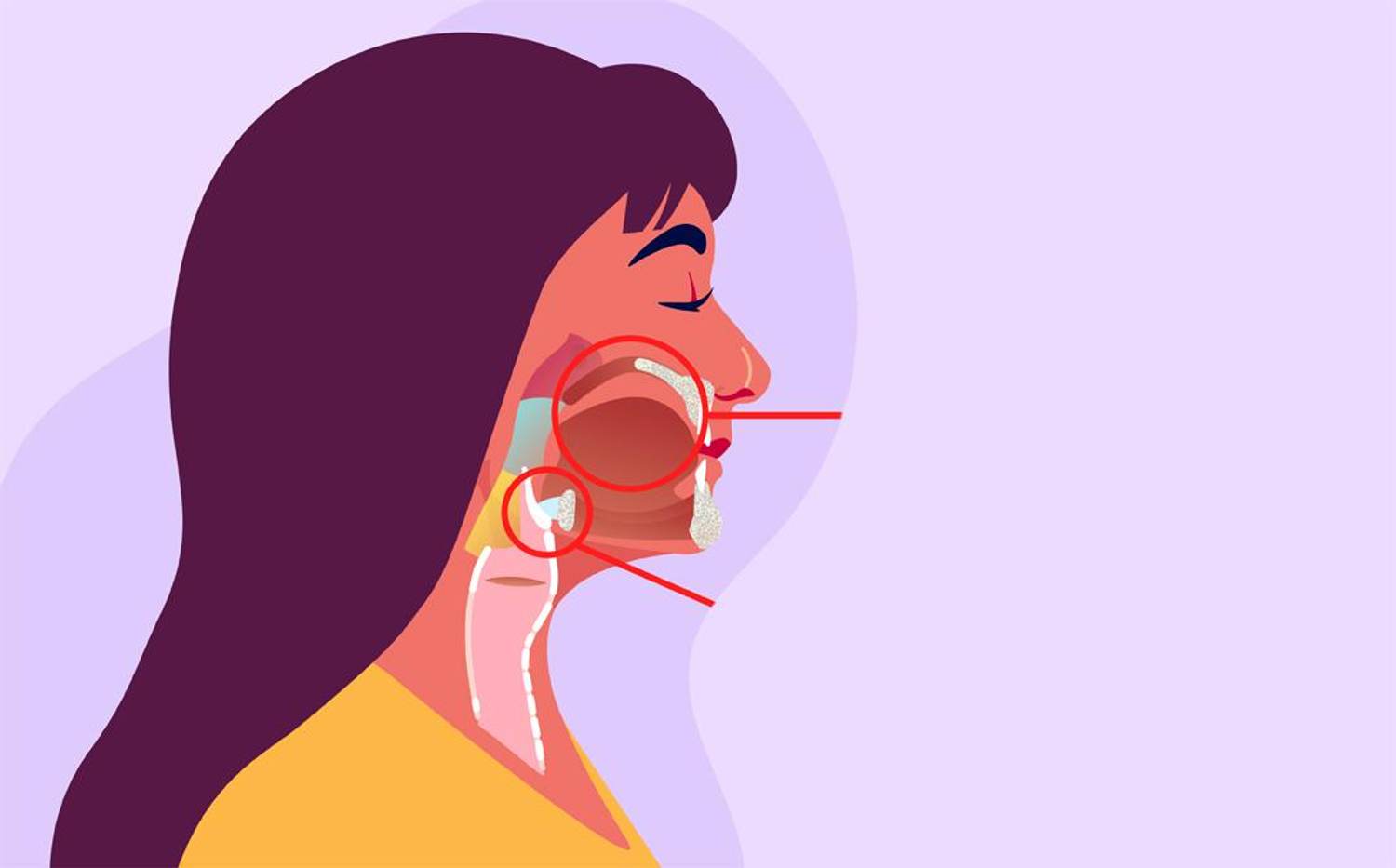 What Is the Link Between HPV & Head and Neck Cancers?