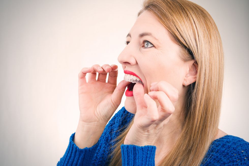 What to Do for Crooked Teeth