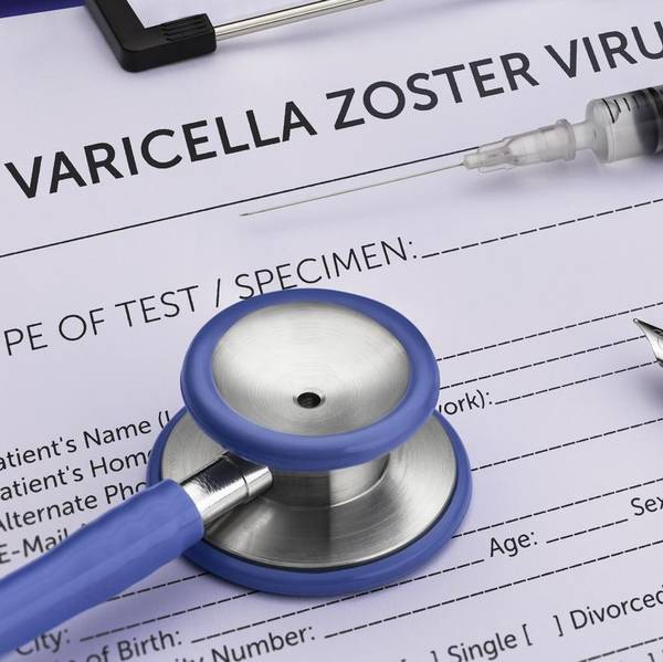 What\u2019s the Connection Between Chickenpox and Shingles?