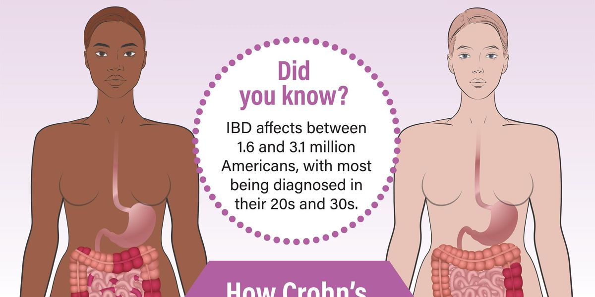 What You Need to Know About Inflammatory Bowel Disease