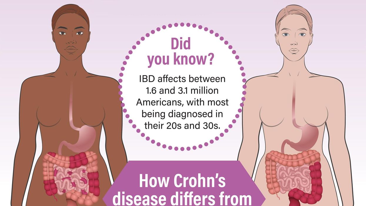 What You Need to Know About Inflammatory Bowel Disease