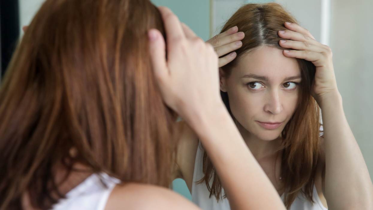 What to Know About Hair Loss Treatments for Women