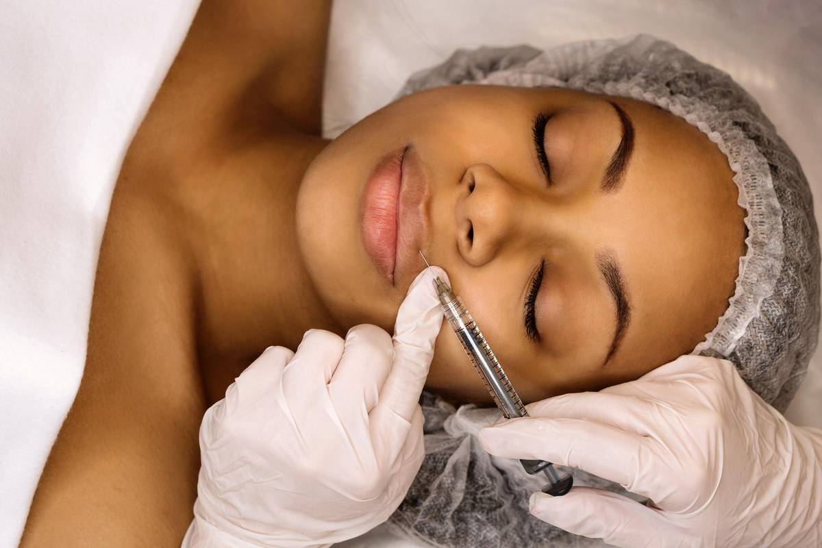 woman getting dermal fillers