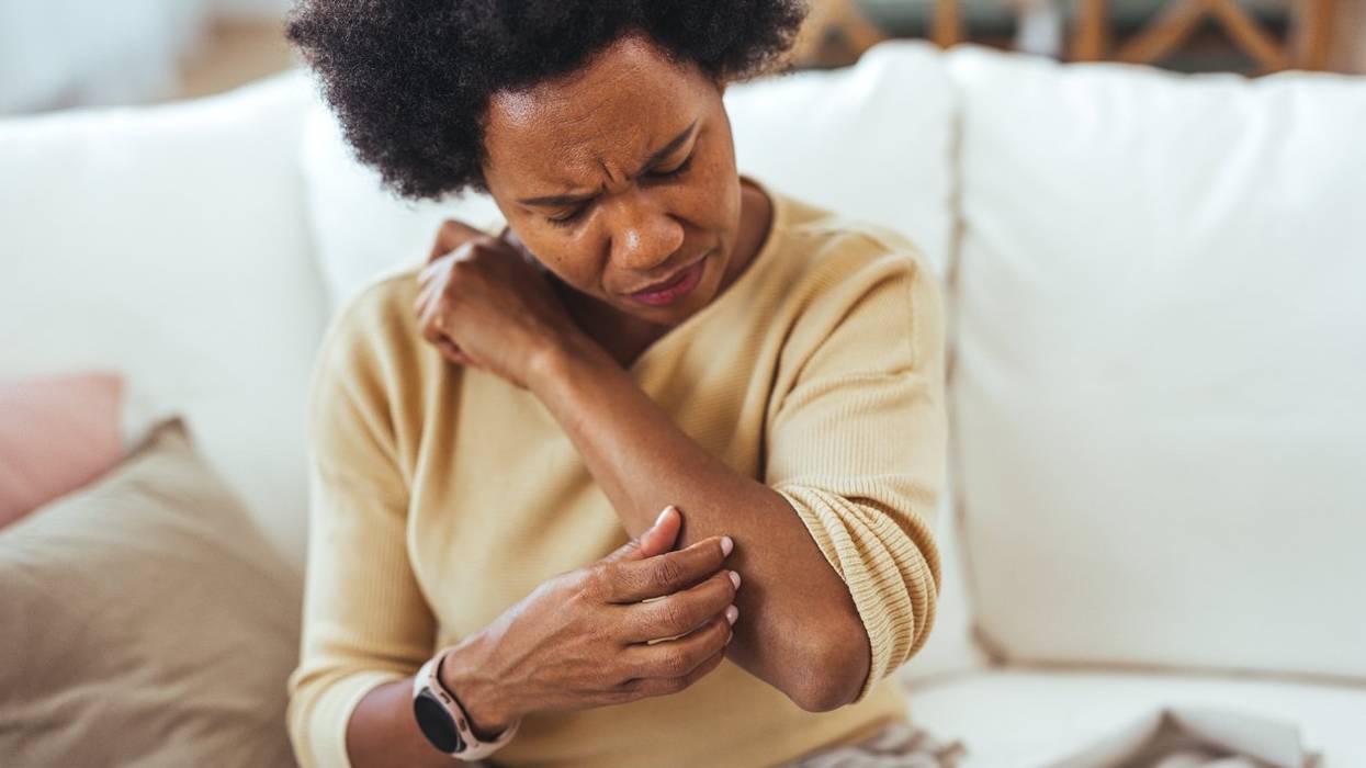 Woman Scratching Arm While Experiencing Skin Irritation