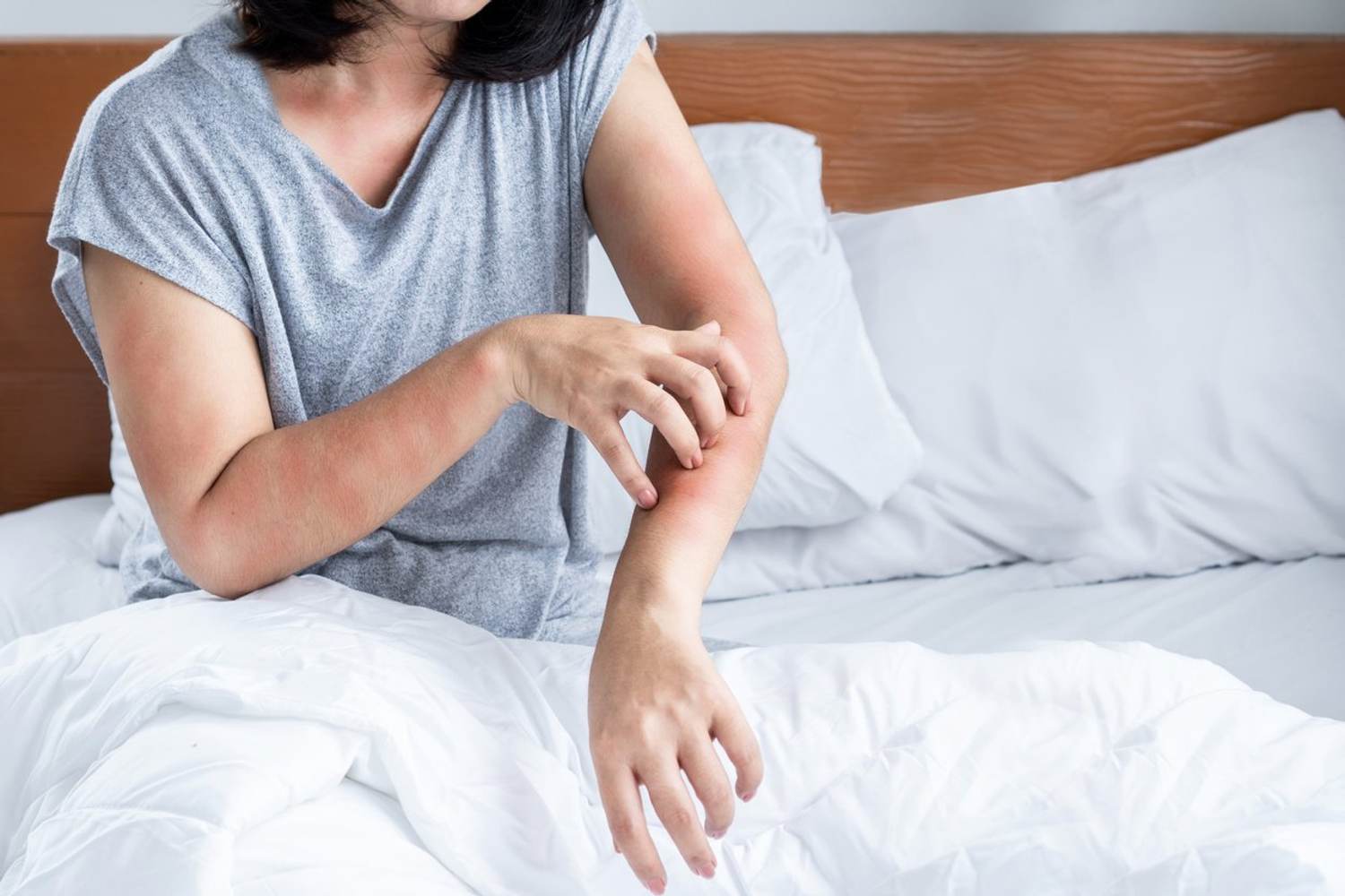 Unexplained Itching and Fatigue? Time to Get Your Liver Checked