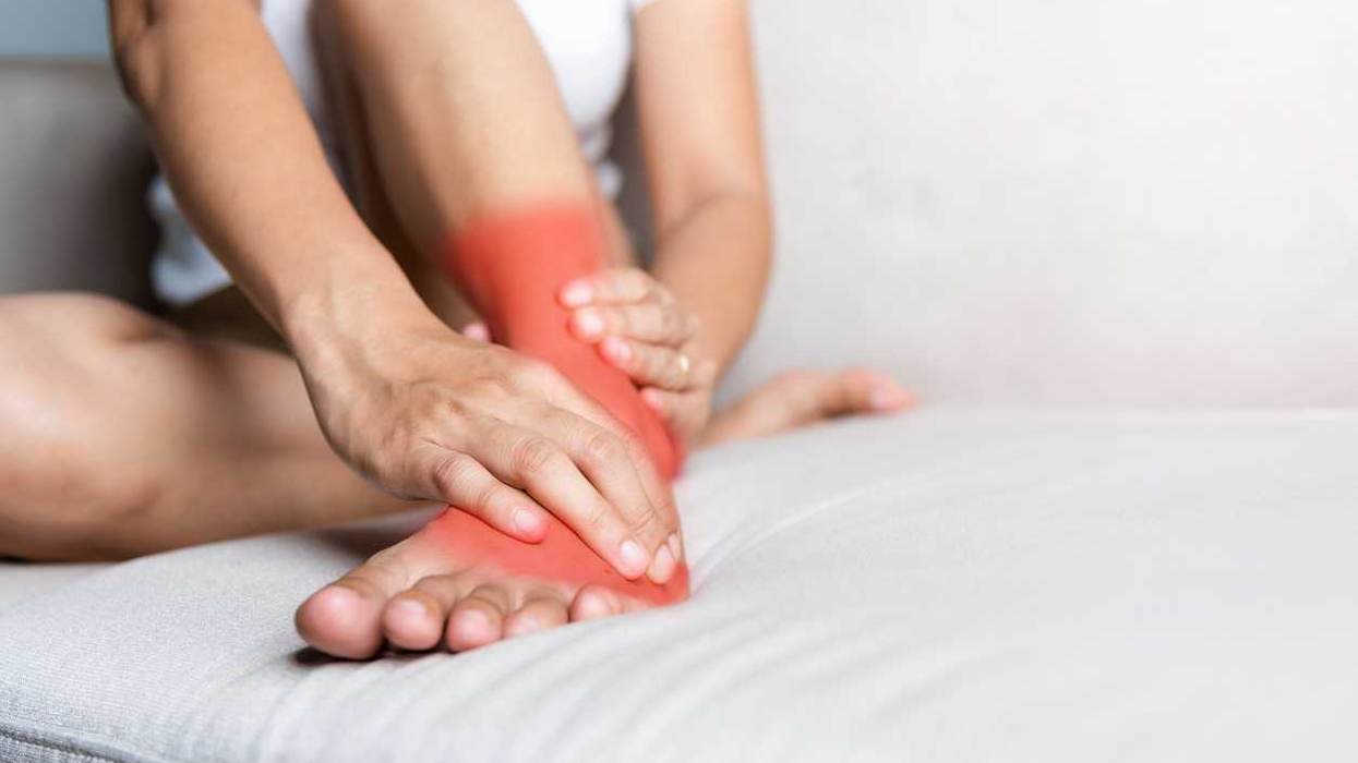 Complex Regional Pain Syndrome (CRPS) 101