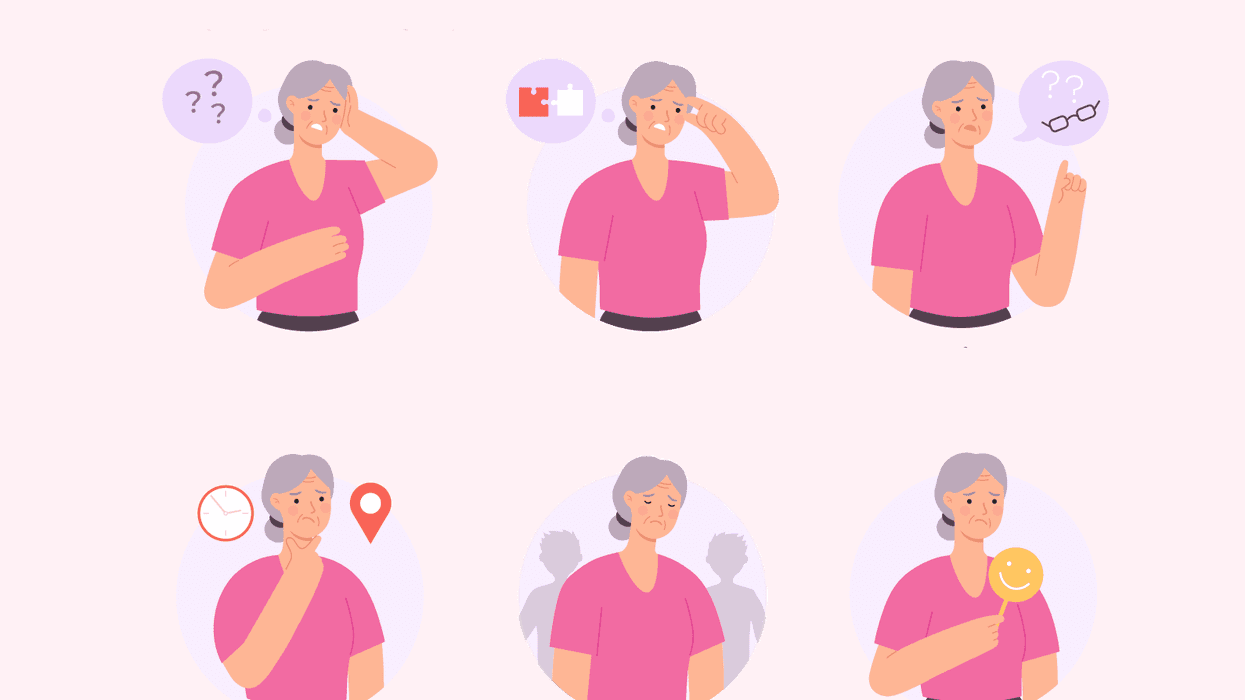 Treatment Options for Alzheimer’s Disease