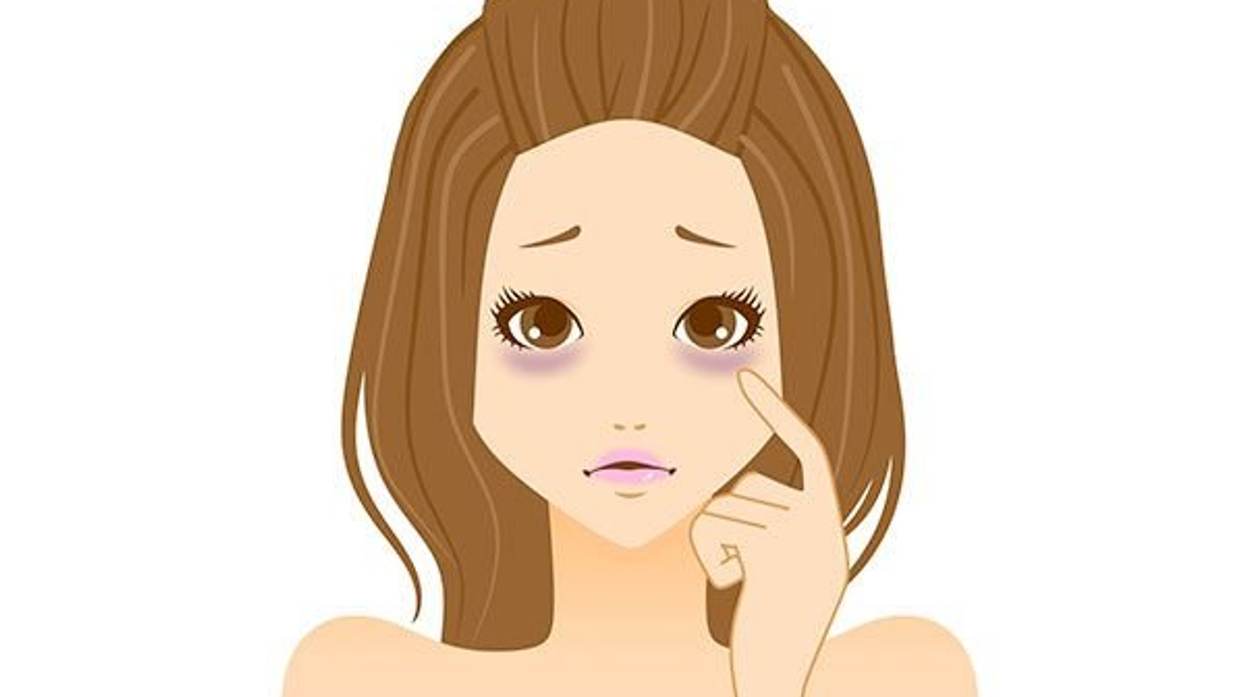 What Causes Under-Eye Circles and How to Get Rid of Them