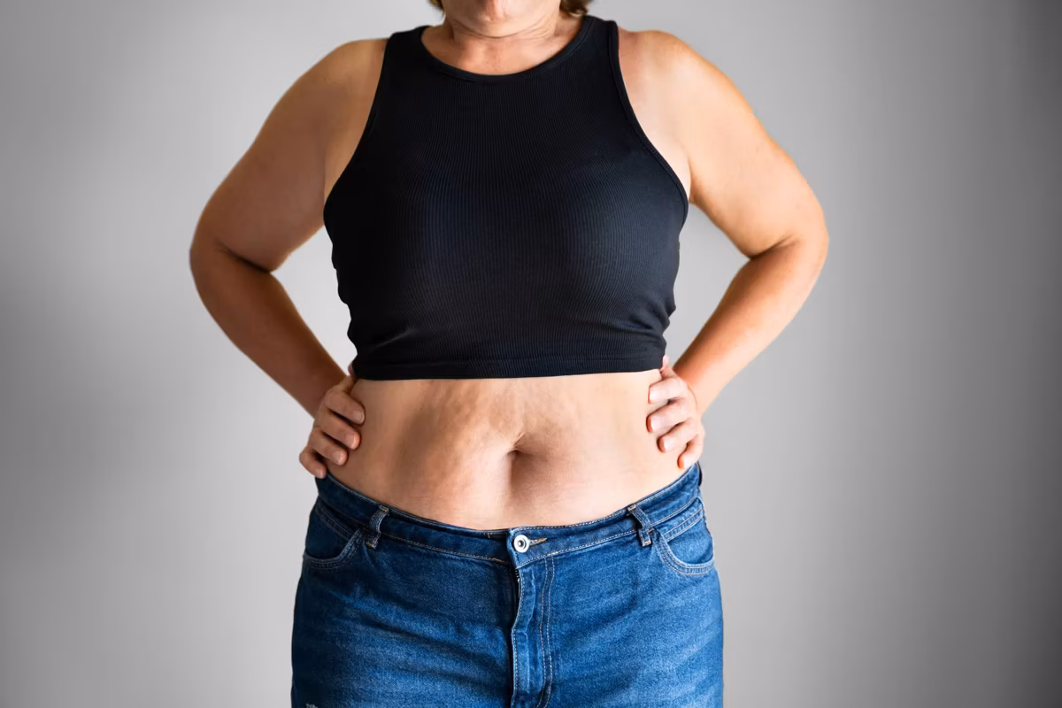 woman with menopause belly