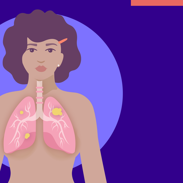 Women Who Have Never Smoked Can Get Lung Cancer