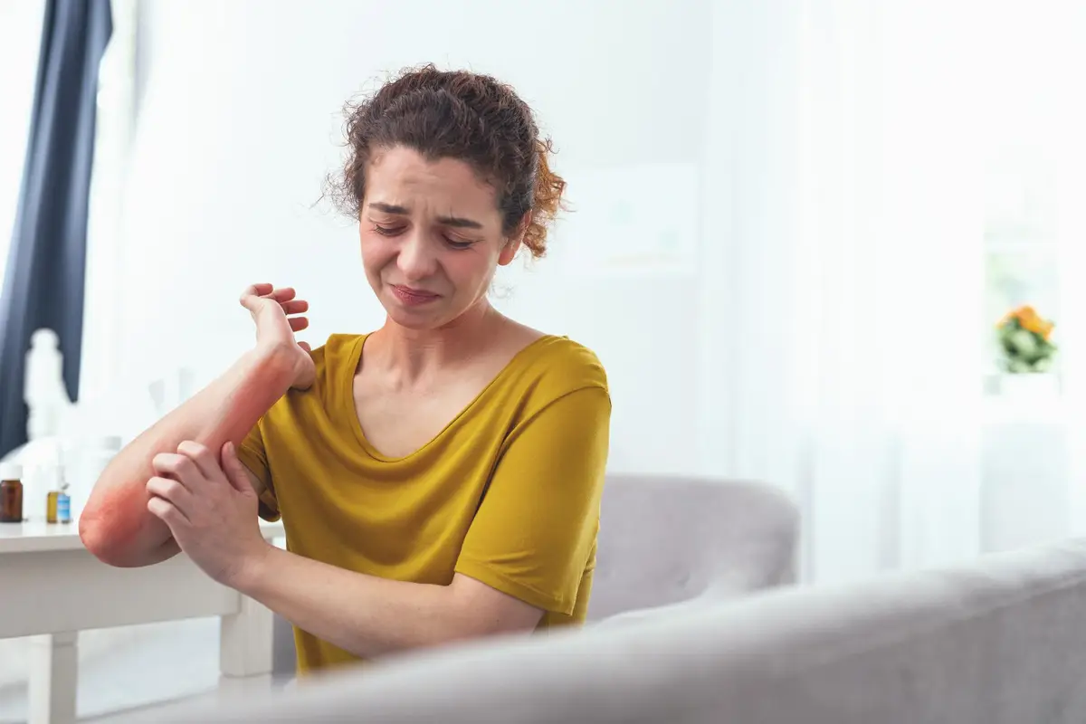 Young girl with Atopic Dermatitis desperately scratching her arm