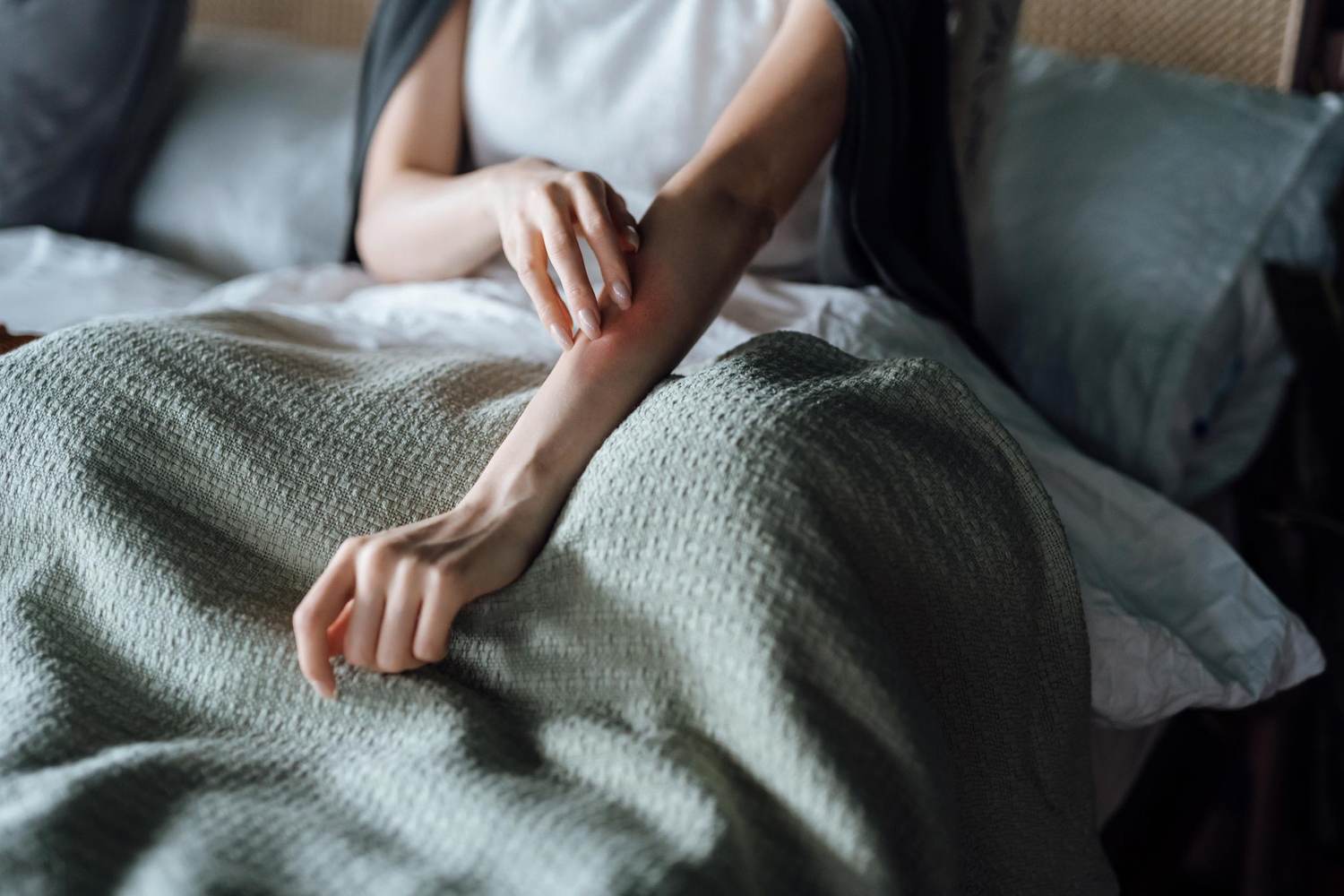How Eczema Affects Sexual Health